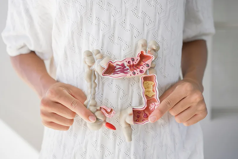 Colorectal Cancer: When You Should Get Checked Earlier