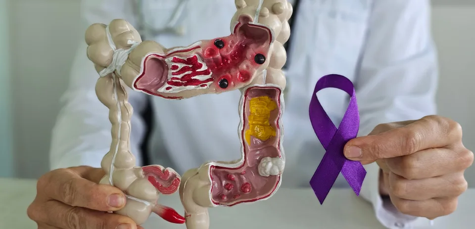 How Often Should You See a Colorectal Specialist?